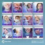 Pack 100 Artes editáveis no canva - dentista, odontologia +Stories - Imagem 5